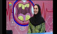 شکاف کام و لب در چه سنی قابل درمان است